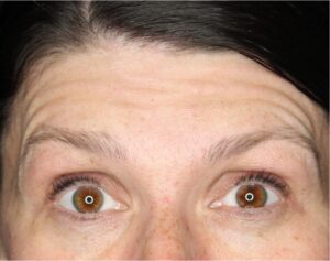 Wrinkle Relaxers