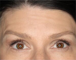 Wrinkle Relaxers