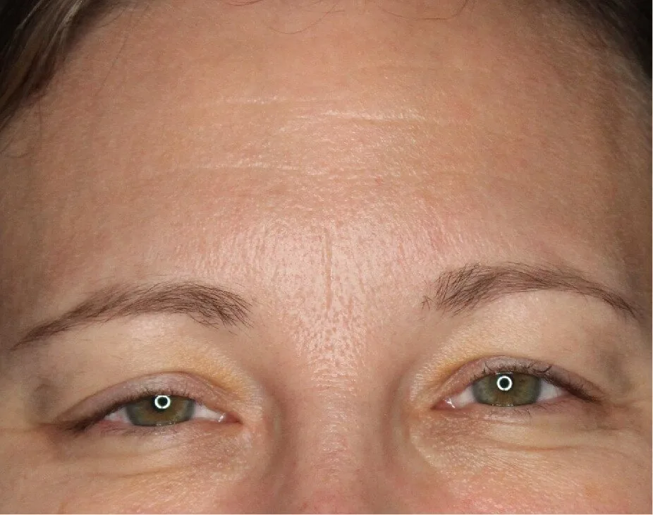Wrinkle Relaxers
