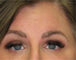 Wrinkle Relaxers