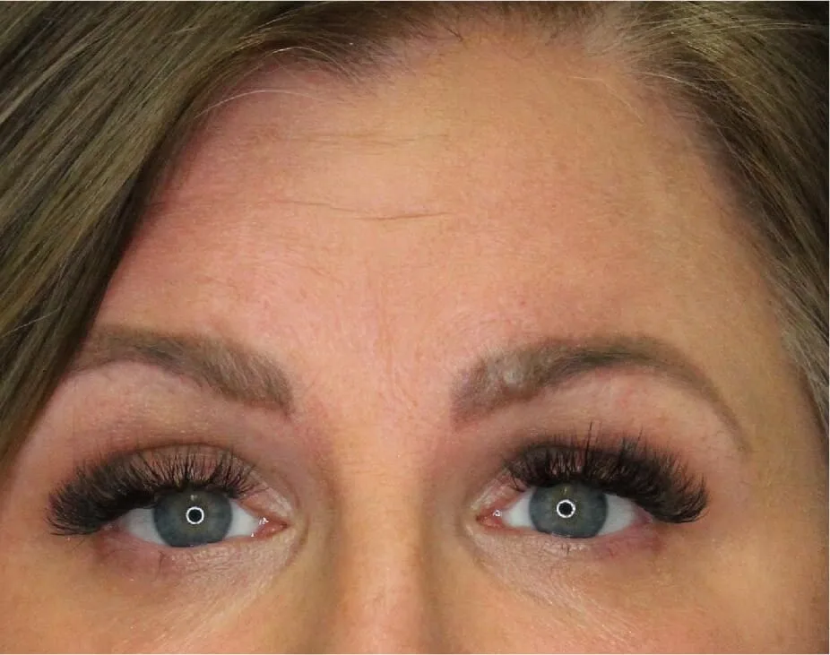 Wrinkle Relaxers