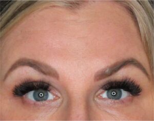 Wrinkle Relaxers