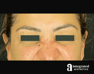 Wrinkle Relaxers