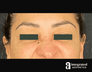 Wrinkle Relaxers