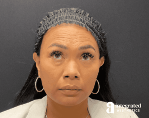 Wrinkle Relaxers