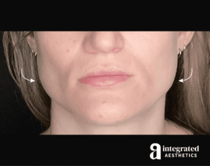 Wrinkle Relaxers