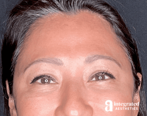 Wrinkle Relaxers