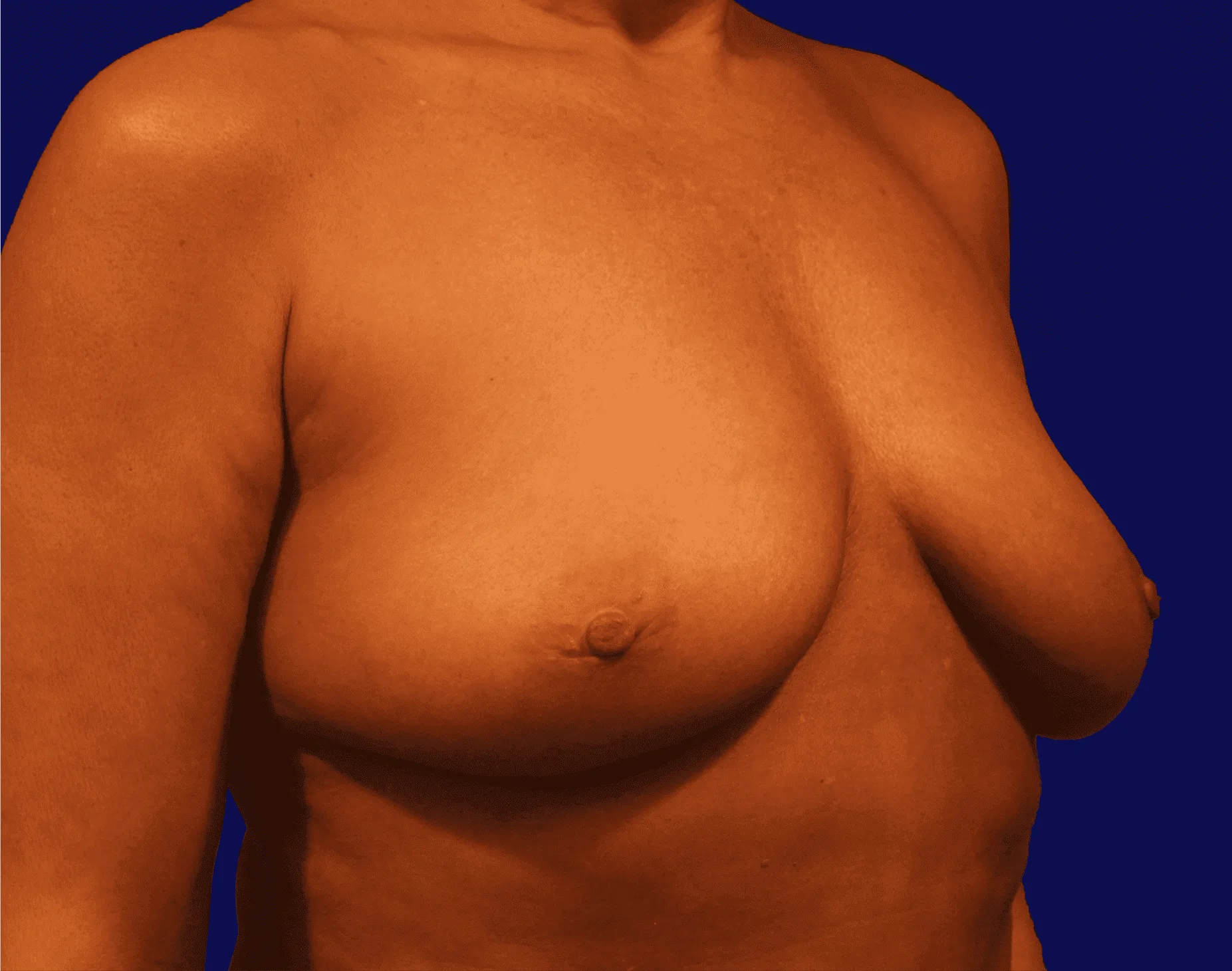 1720649401-climov-10-breasts-12.png