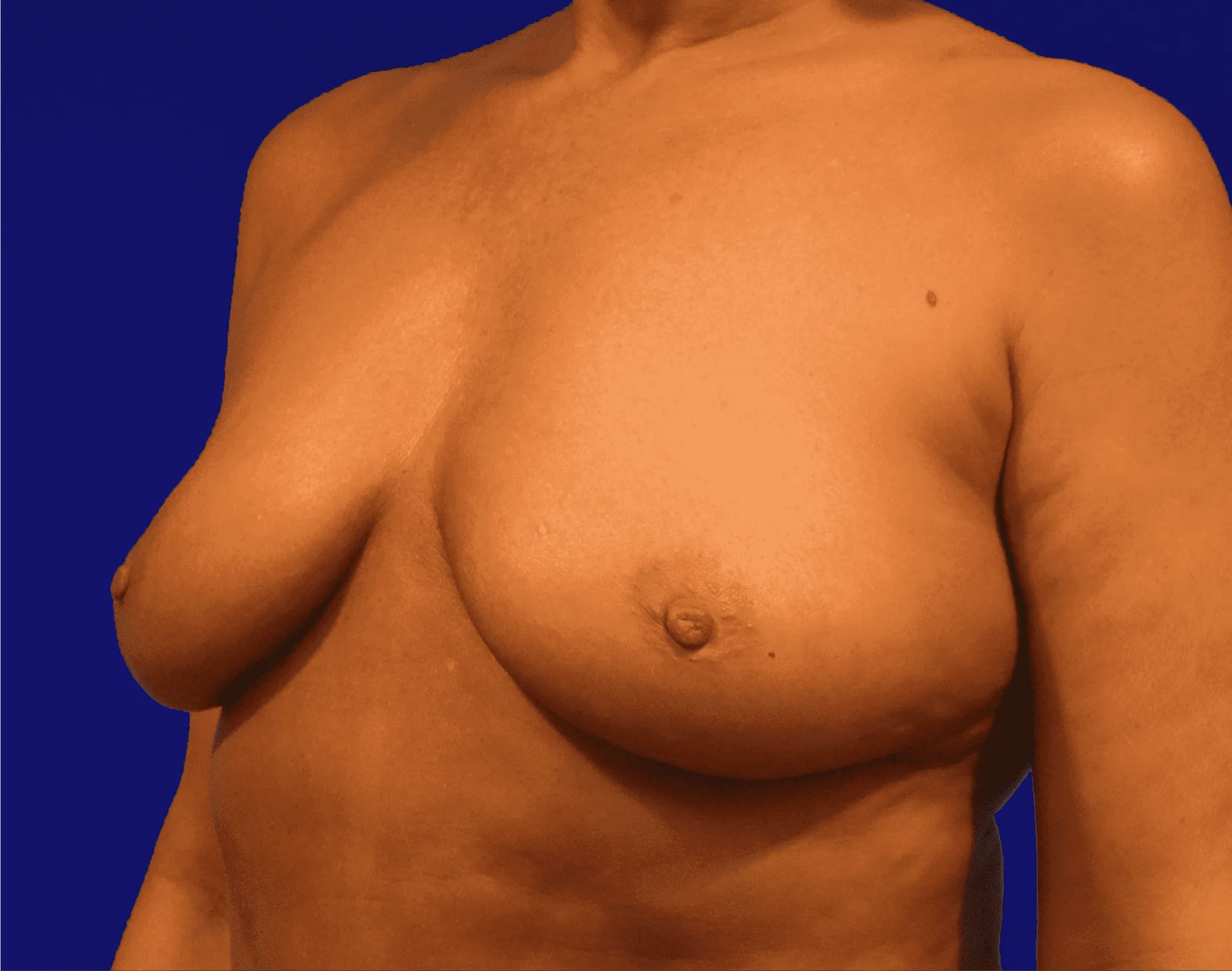 1720649430-climov-10-breasts-14.png