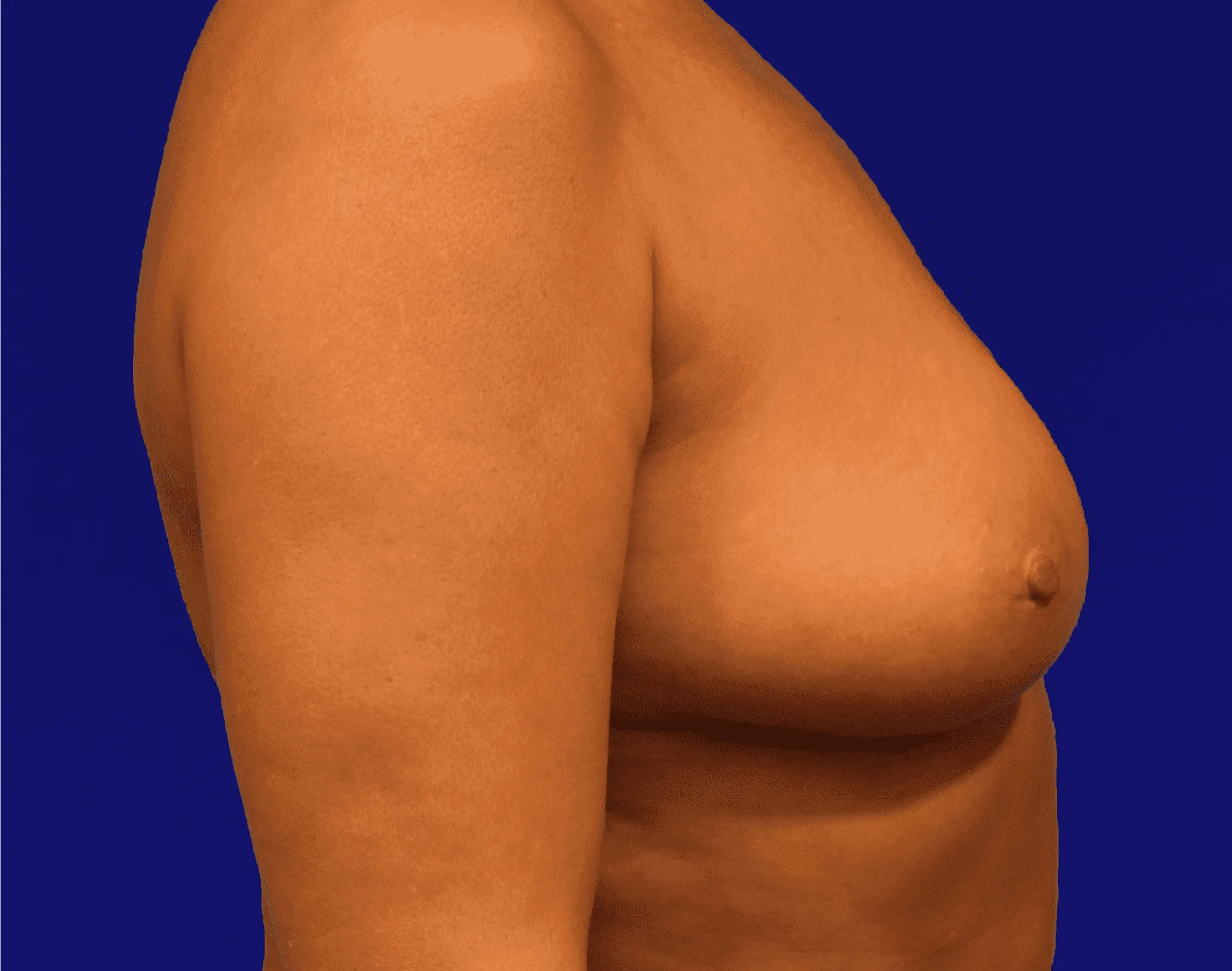 1720649460-climov-10-breasts-16.png