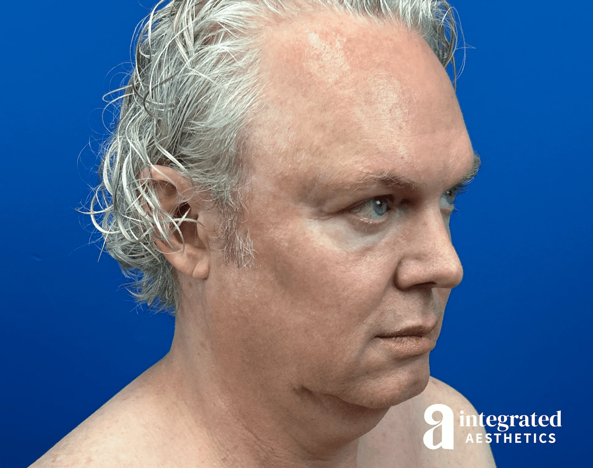 1723842782-beforeandafter09126-12.png