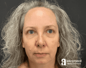 Wrinkle Relaxers
