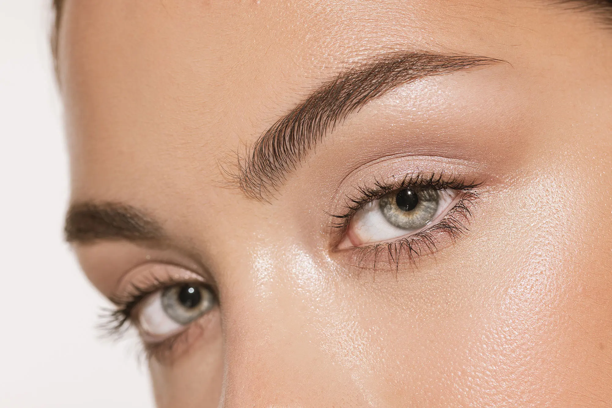 Endoscopic brow lift