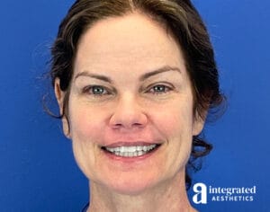 Wrinkle Relaxers