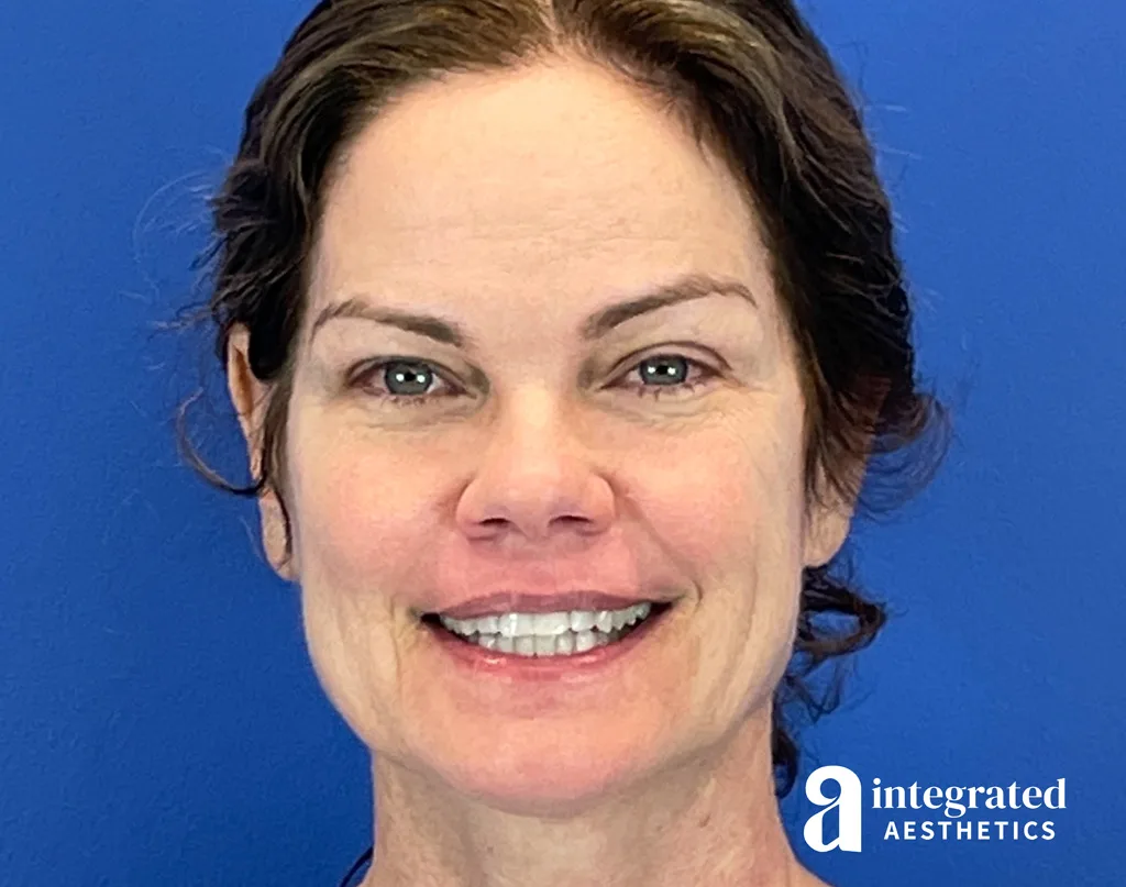 Wrinkle Relaxers