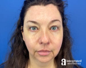 Wrinkle Relaxers