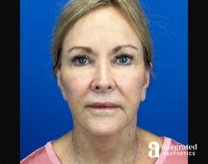 Facial Combined Procedures
