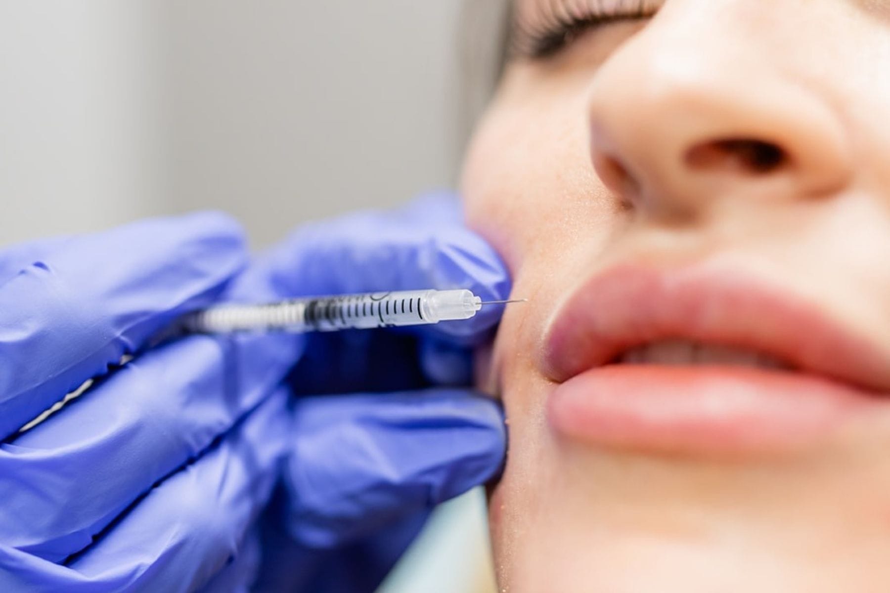 Why You Should Never Get Permanent Lip Fillers