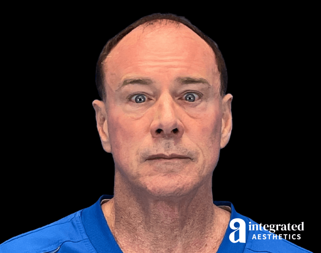 Wrinkle Relaxers