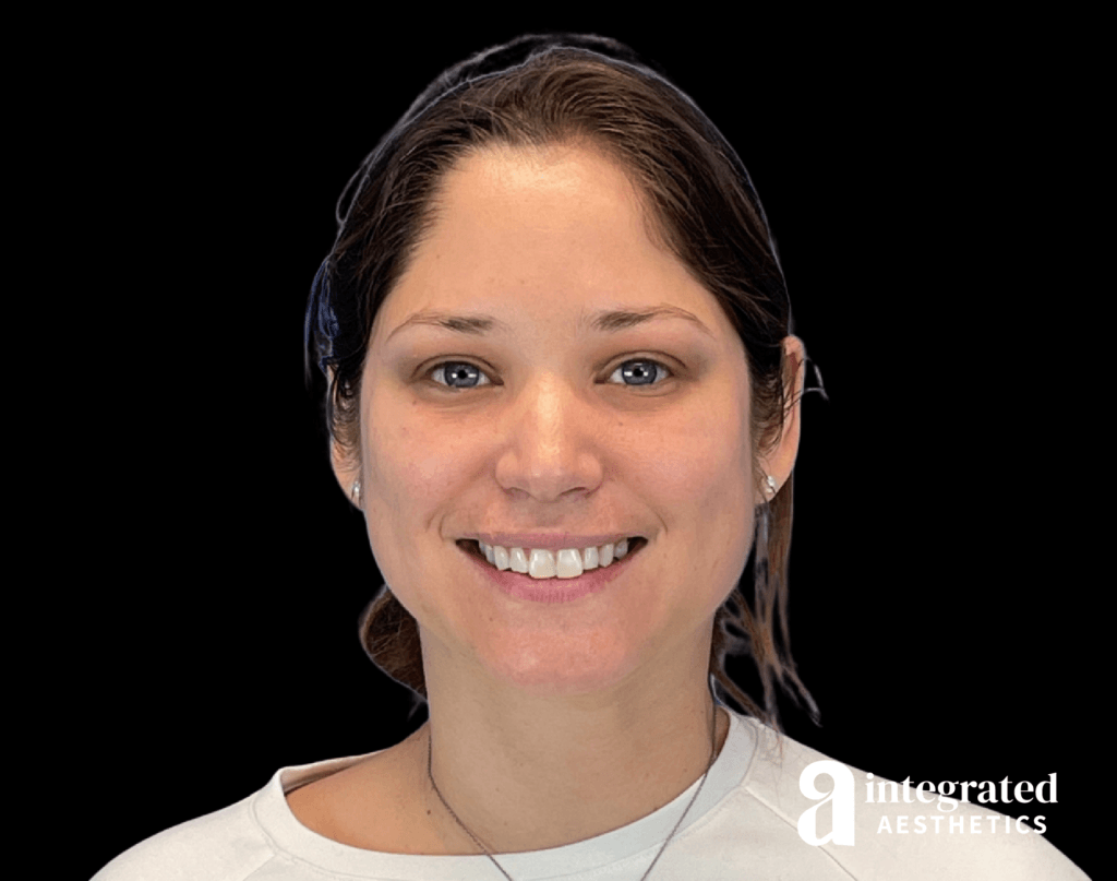 BeforeandAfter29171-13