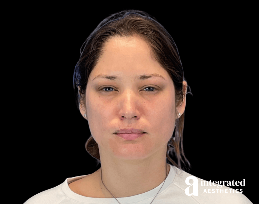 BeforeandAfter29171-15