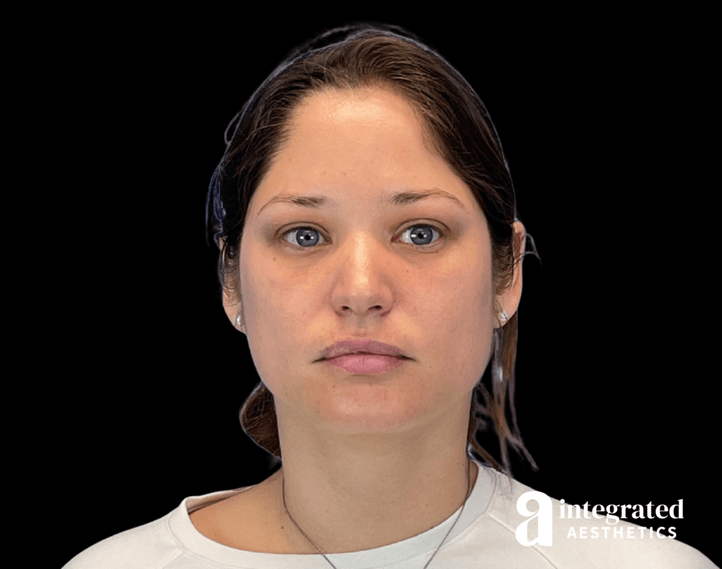 BeforeandAfter29171-17