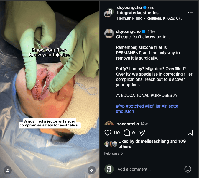 View our Instagram post detailing a lip silicone filler removal case study by Dr. Young Cho at Integrated Aesthetics in The Woodlands and Spring, TX.
